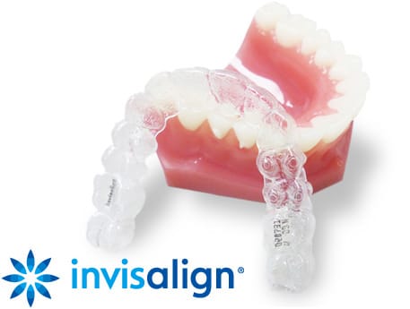 invisalign